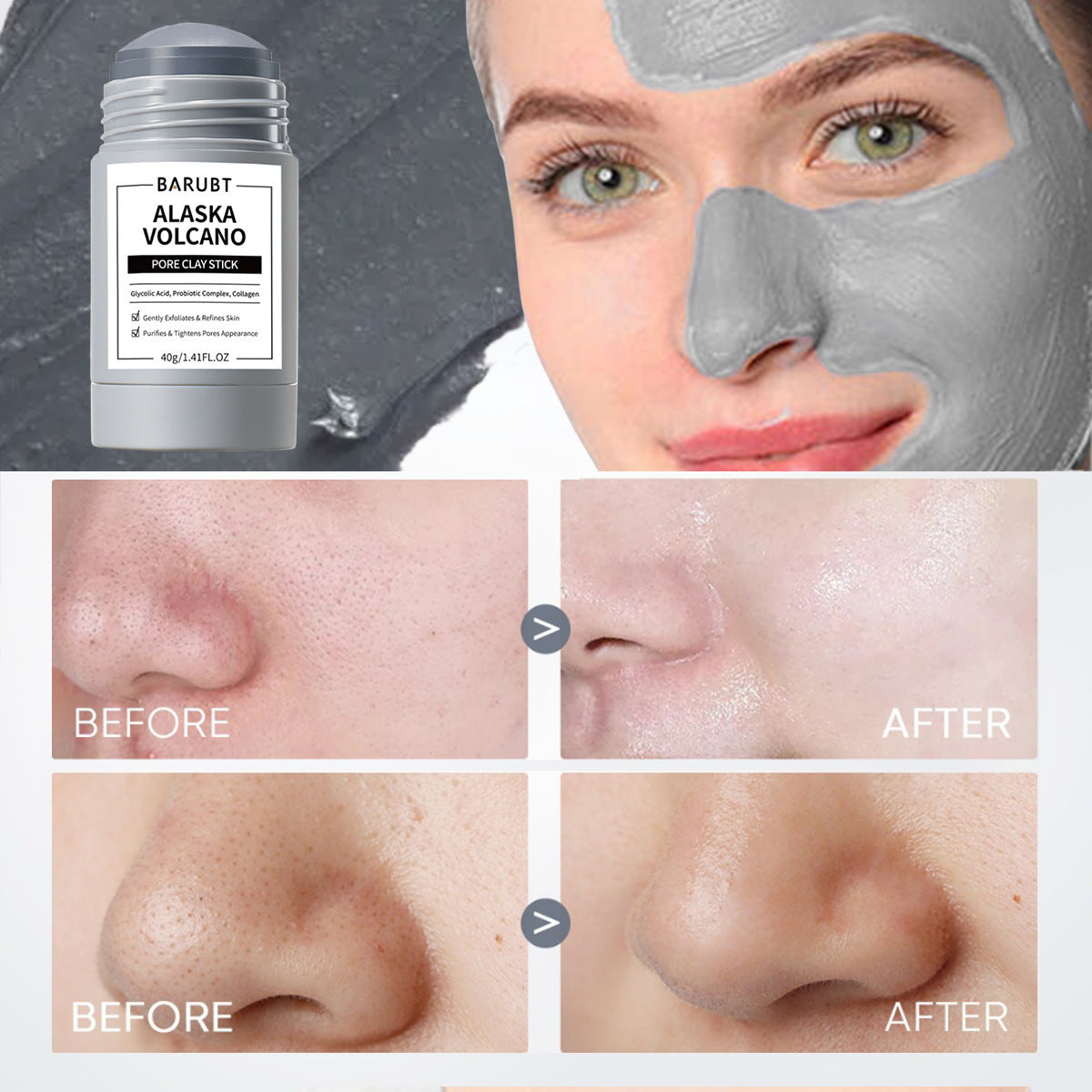 Masque d'application doux pour le visage réparateur de points noirs