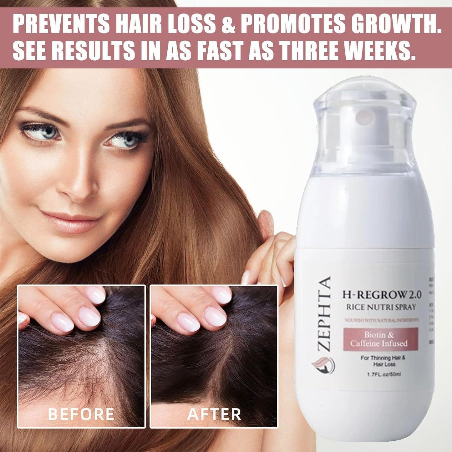 Spray pour la croissance des cheveux