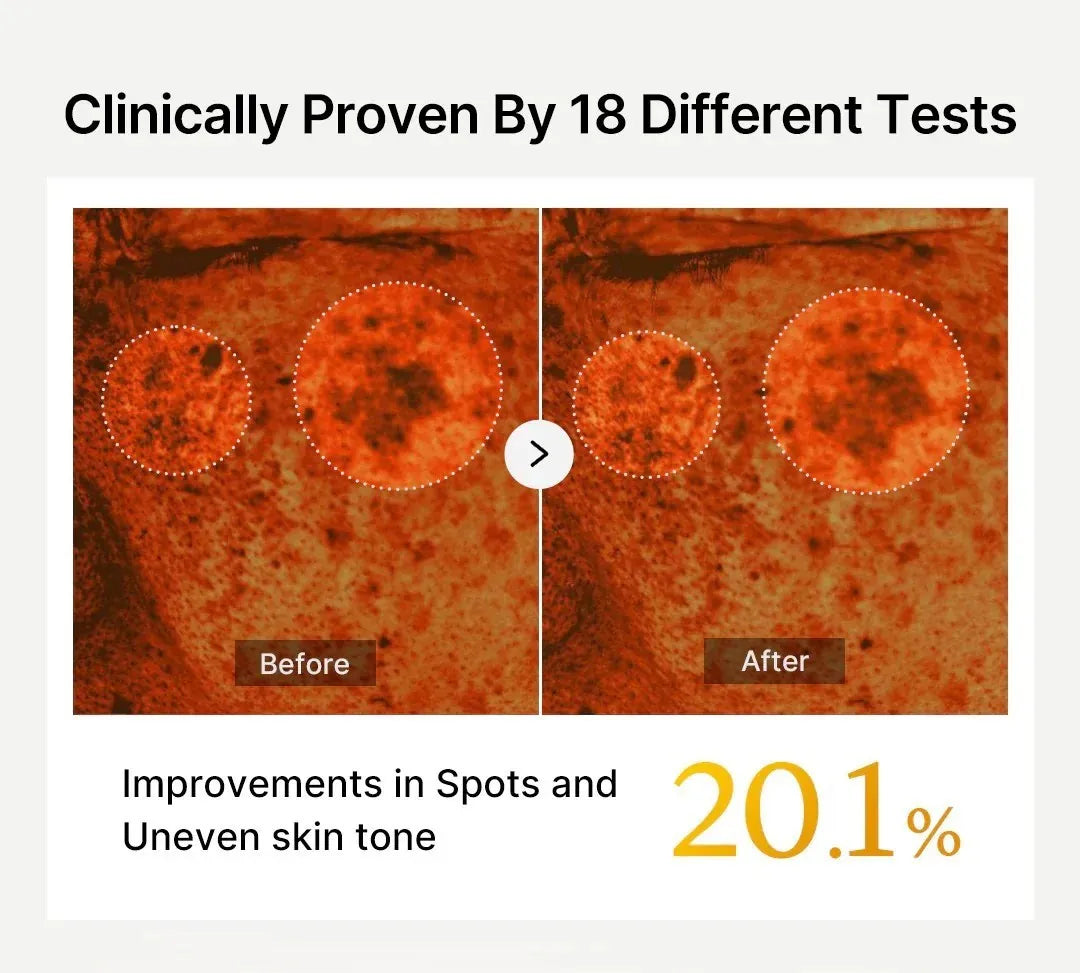 Capsule de Vitamine C Éclat