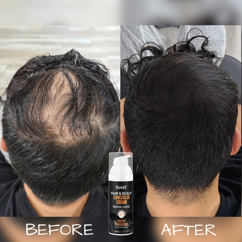 Cache-cuir chevelu pour cheveux clairsemés