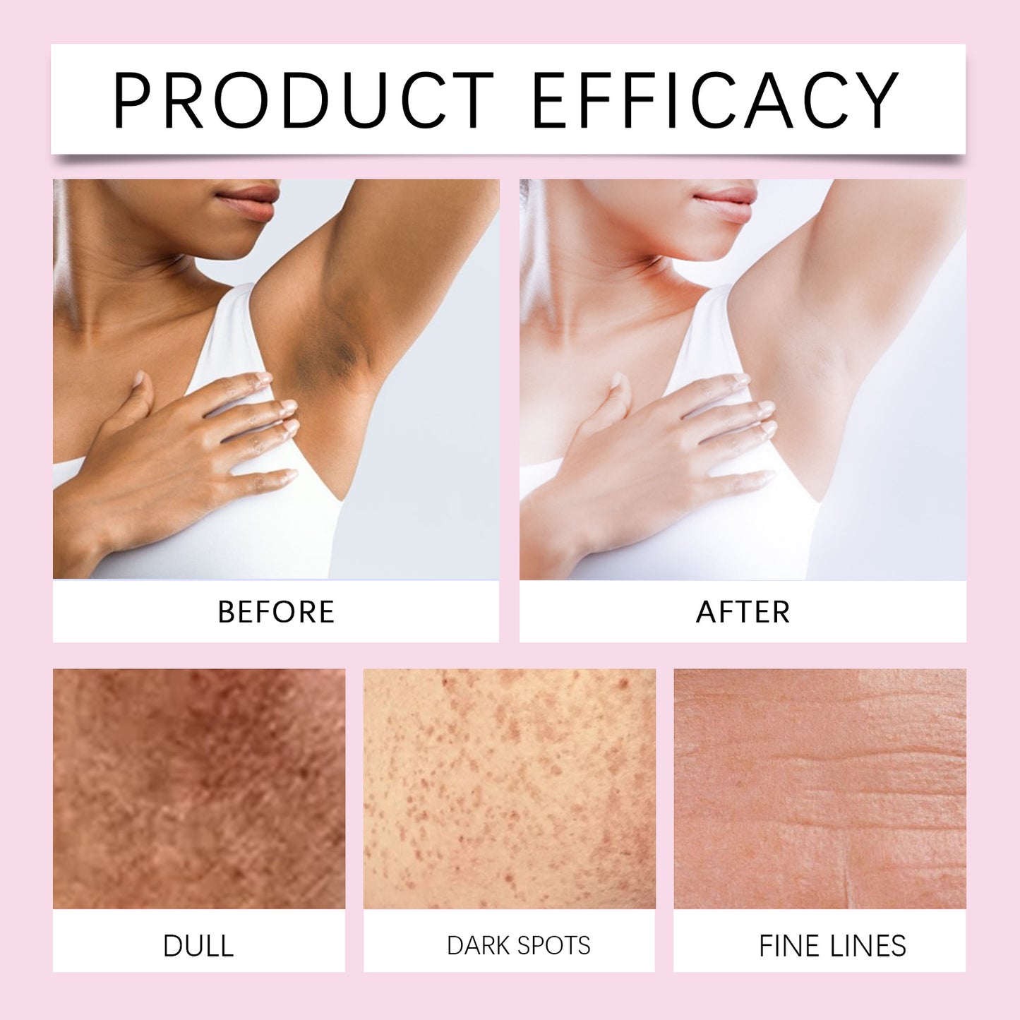 Crème hydratante correctrice de taches brunes pour le corps
