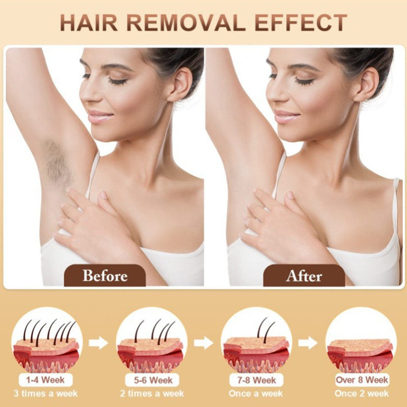 Appareil d'epilation laser IPL